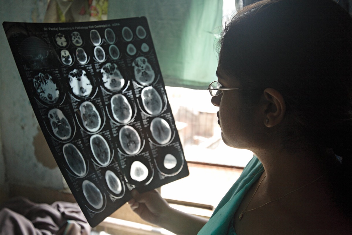 urgent action needed on neurological care