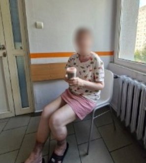 Mirella spent months in recovery after she was found.