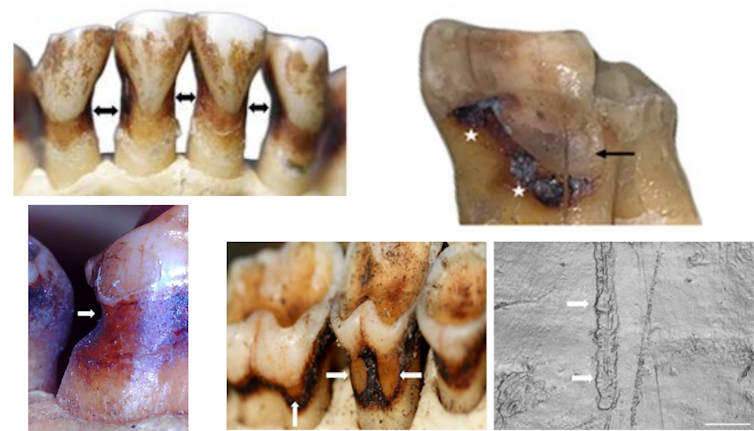 Primate dentitions with different types of dental pathologies
