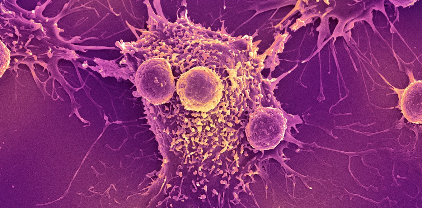 COVID-19 mRNA vaccines could unlock the next revolution in cancer treatment – new research