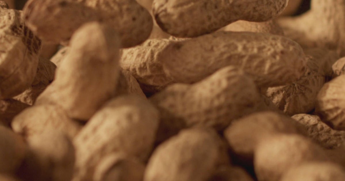 Some 60,000 kids have avoided peanut allergies due to landmark 2015 advice, study finds