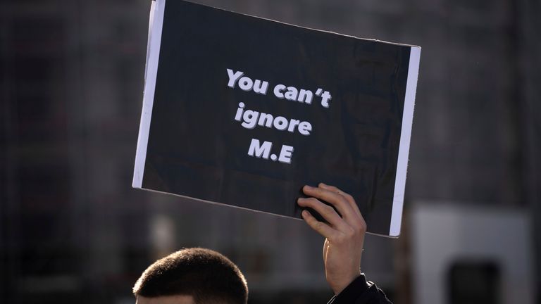 The condition is not uncommon, but can be a challenge to diagnose. File pic: AP