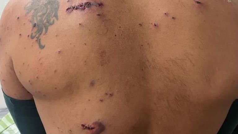 Roei was shot in the back twice. Pic: Instagram/@roeishalev