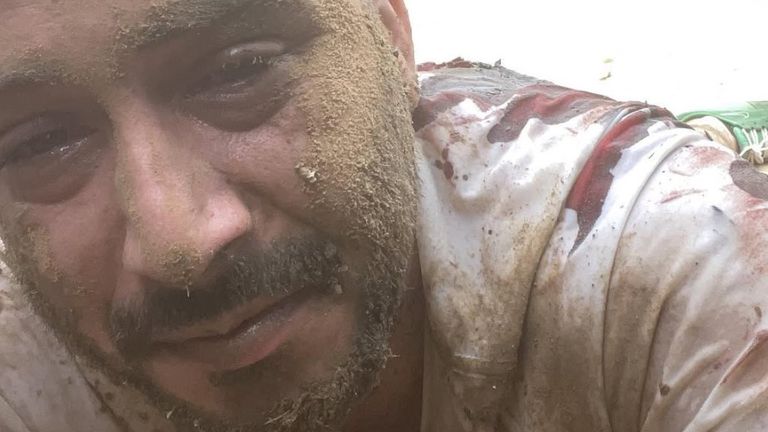 Roei played dead for seven hours, covered in his and his girlfriend's blood. Pic: Instagram/@roeishalev