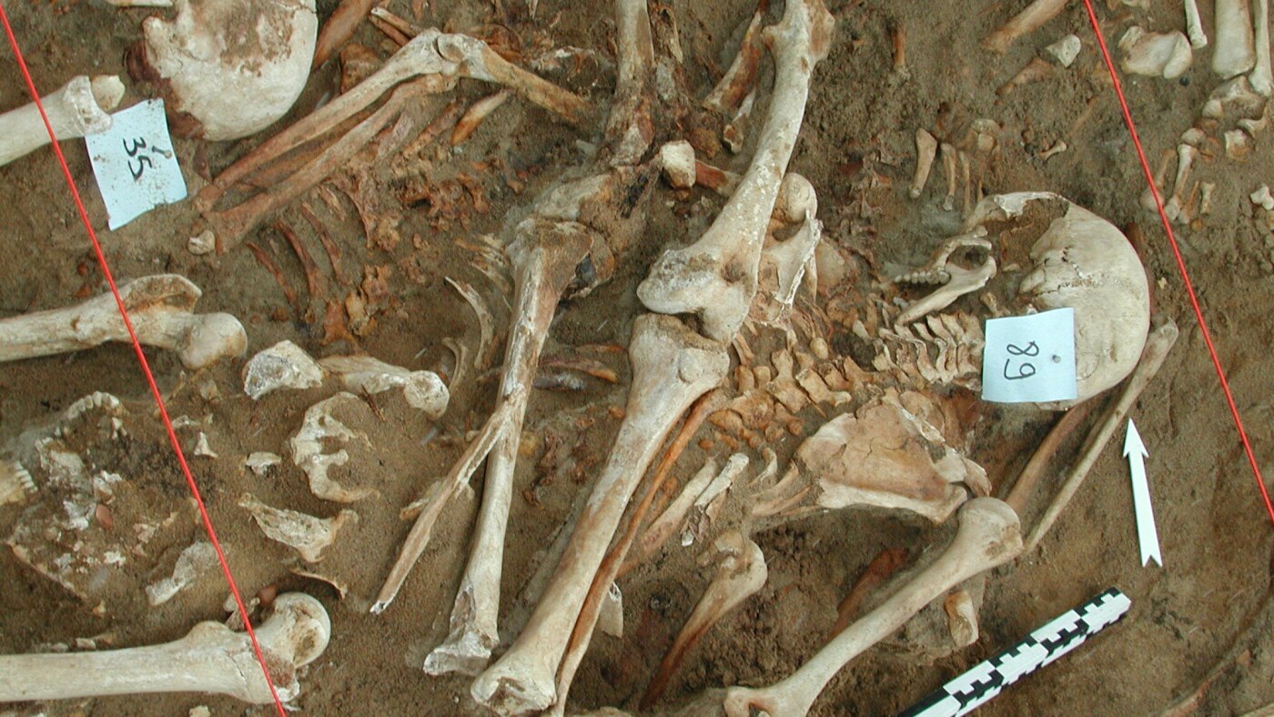 What killed Napoleon's army? Scientists find clues in DNA from fallen soldiers' teeth : Shots