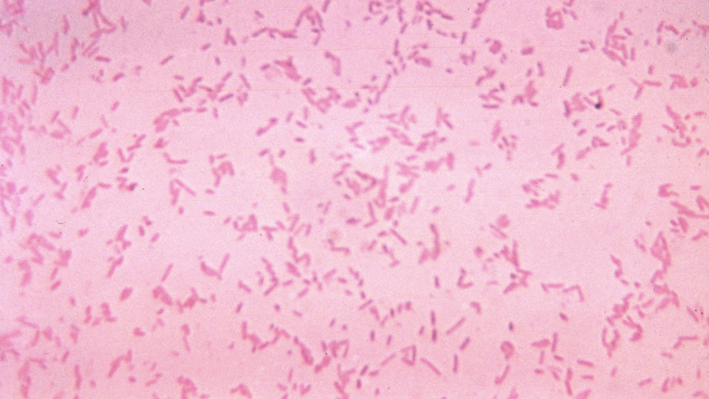 Antibiotic resistance is rising at an alarming rate : Goats and Soda : NPR