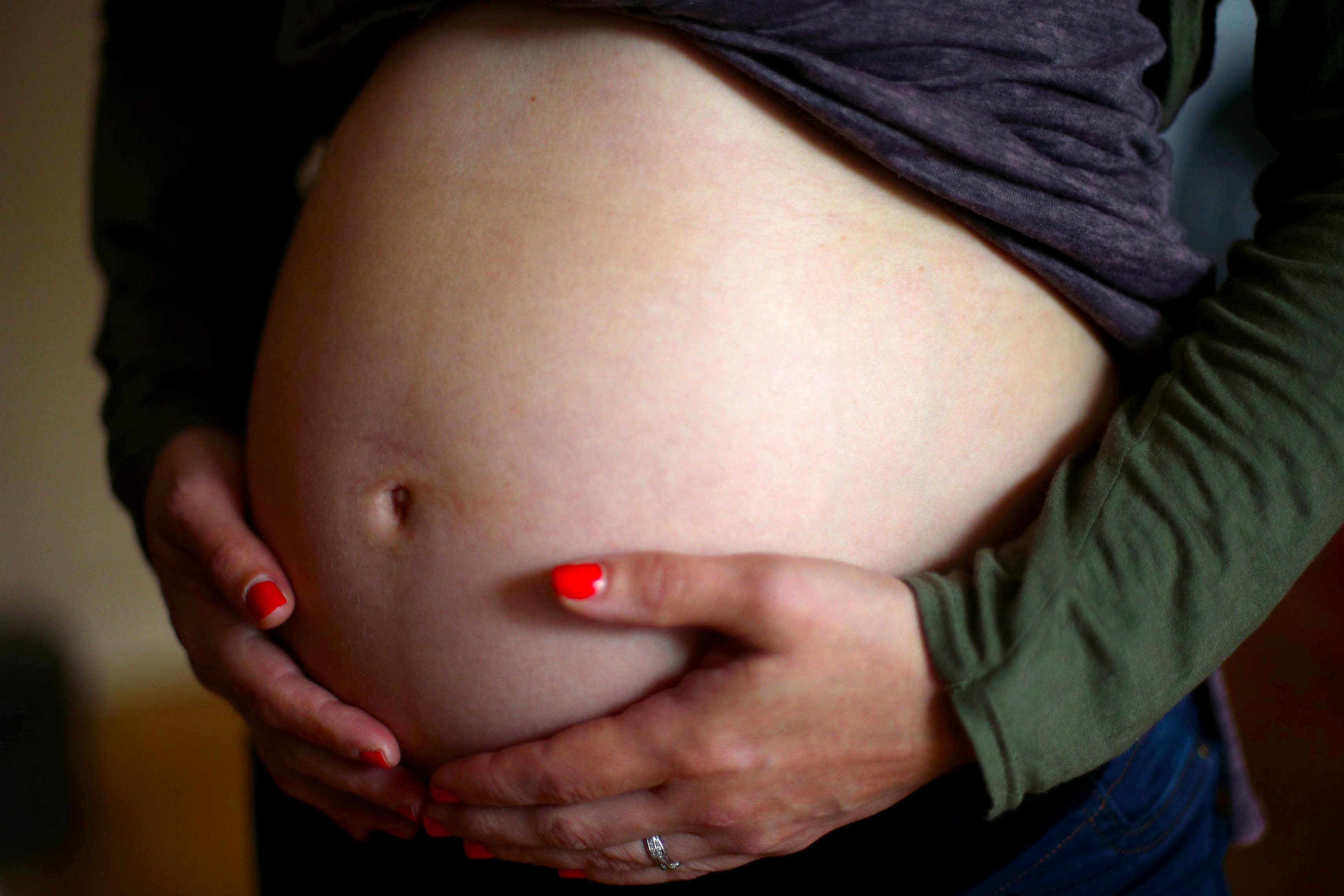 The study examined complications for both mother and baby with weight loss or gain
