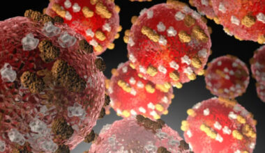 SunLive - New measles case, travelled through two airports