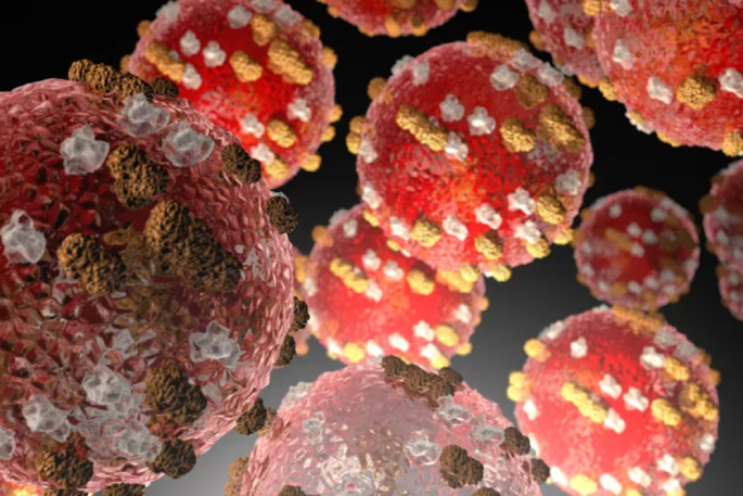 SunLive - New measles case, travelled through two airports