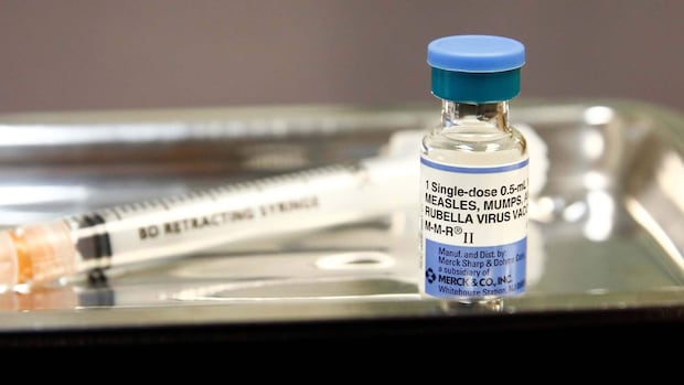 Alberta's role in Canada's loss of measles elimination status embarrassing, former chief medical officer says