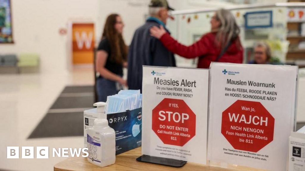 Canada loses measles elimination status, with US on track to follow