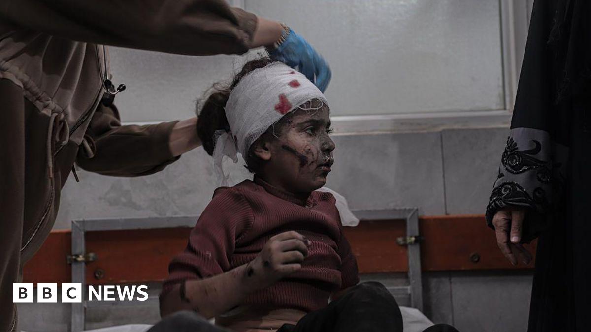 An injured Palestinian girl has her head bandaged at al-Shifa hospital in Gaza City following an Israeli strike (19 November 2025)