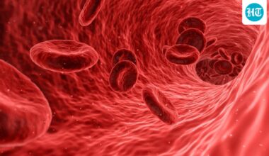 Longevity doctor reveals plaque buildup in arteries can be reversed; shares 4 steps to remove it in 12 months