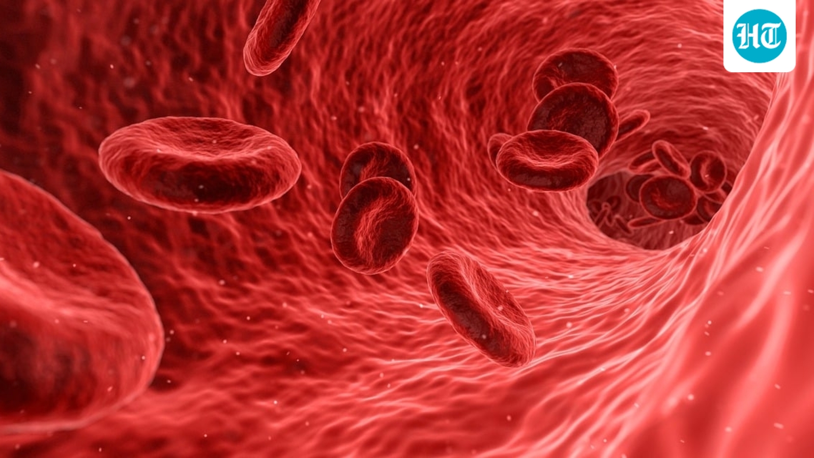 Longevity doctor reveals plaque buildup in arteries can be reversed; shares 4 steps to remove it in 12 months