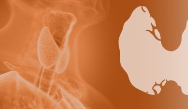 Thyroid dysfunction during pregnancy may increase autism risk in children