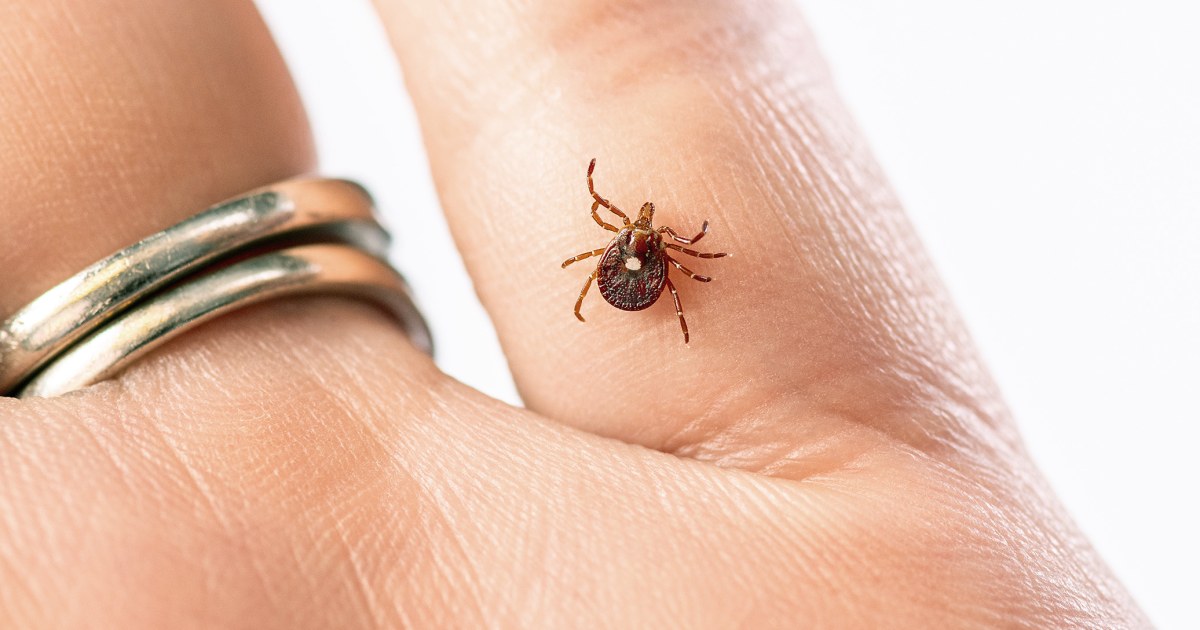 First death reported from meat allergy caused by tick bite