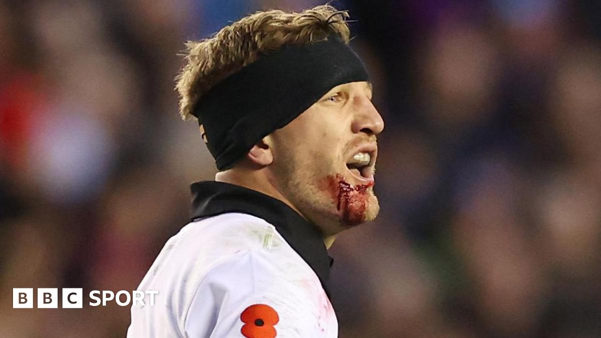 New Zealand's Damian McKenzie bleeds from a cut chin