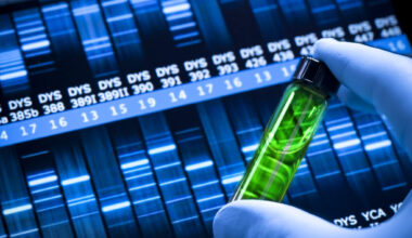 Genetic Testing Trifecta Predicts Risk of Sudden Cardiac Death and Arrhythmia