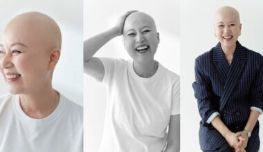 Park Mi-sun Shares Bald Photo, Embraces Positivity in Cancer Battle - 조선일보