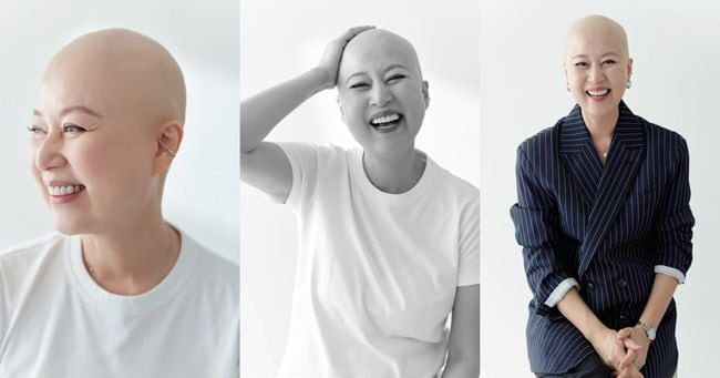 Park Mi-sun Shares Bald Photo, Embraces Positivity in Cancer Battle - 조선일보