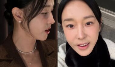 Lee Ji-hye Shares Post-Philtrum Reduction Life, Joy - 조선일보