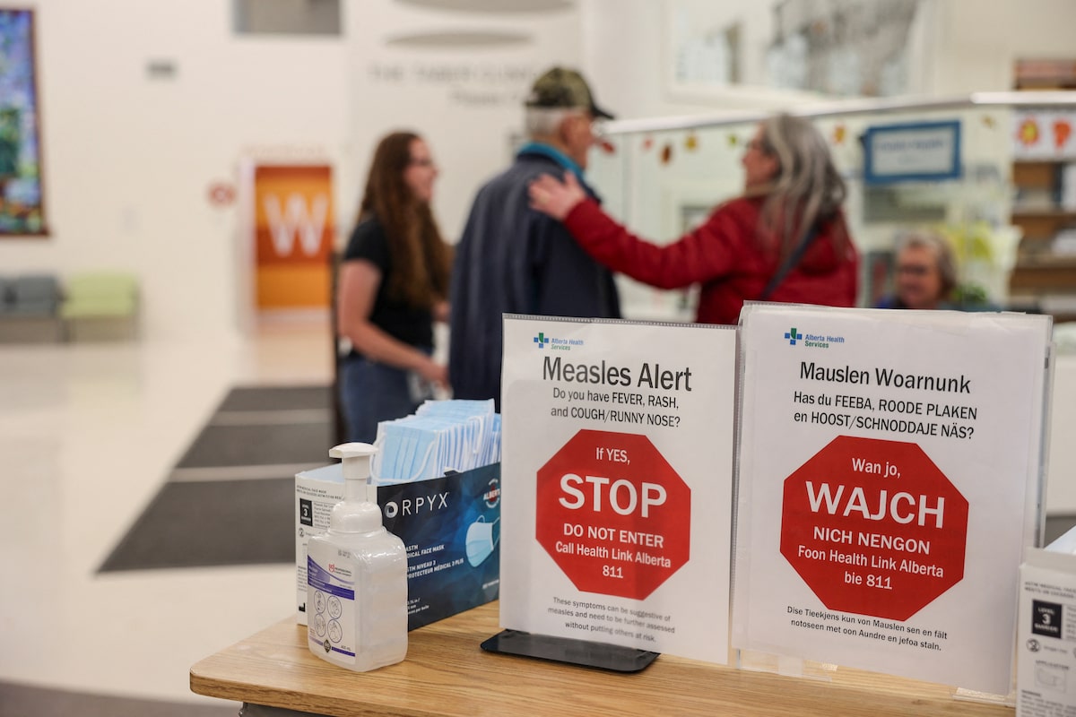 Canada expected to lose long-standing measles-elimination status