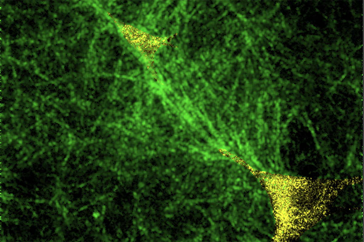 Tissue ‘tipping points’: How cells collectively switch from healthy to disease states - The Source