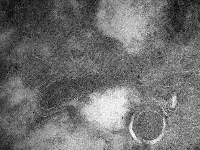 Bacteria on the Brain - Life Sciences | Weizmann Wonder Wander