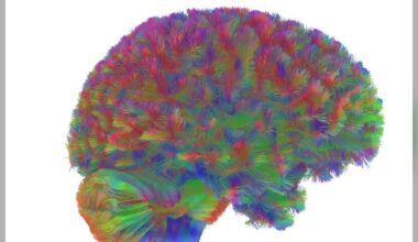 The human brain goes through five phases, with adolescence lasting until age 32: study - CTV News