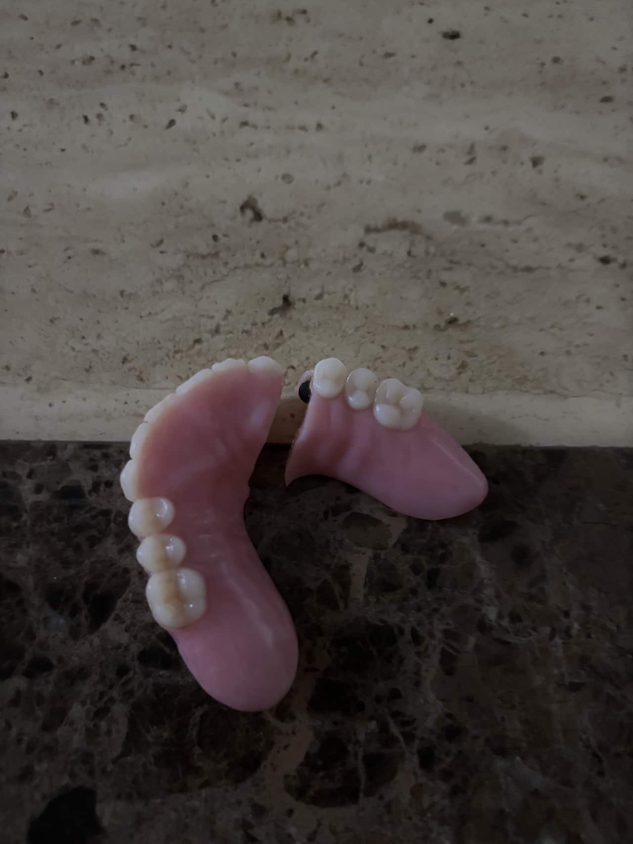 A close-up of teeth dentures which are split in half.