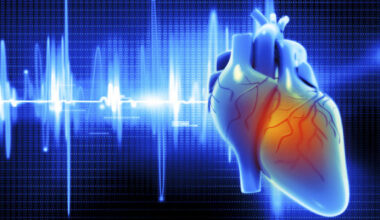 Aortic Valve Replacements and Surgery Show Similar Long-Term Survival Rates 