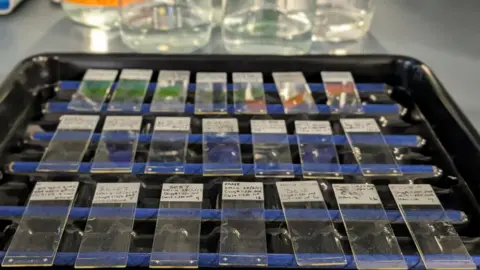 Diabetes UK A black tray with three rows of seven glass slides that can be placed under a microscope. 