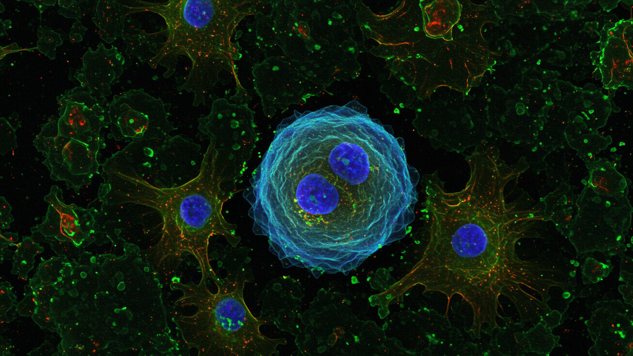 New Weizmann Strategy Recruits Rogue Immune Cells To Help Destroy Cancer