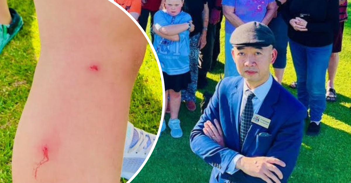 Mosquito outbreak at Warradale Park divides City of Wanneroo as residents left bleeding