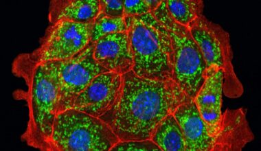 New Drug Protects Mitochondria and Prevents Kidney Injury in Mice