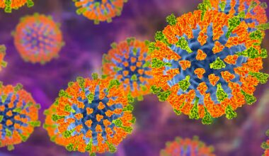 New measles case linked to Auckland Airport brings NZ total to 19