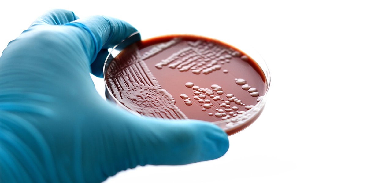 From resistance to resilience: drug-resistant gonorrhoea in 2025