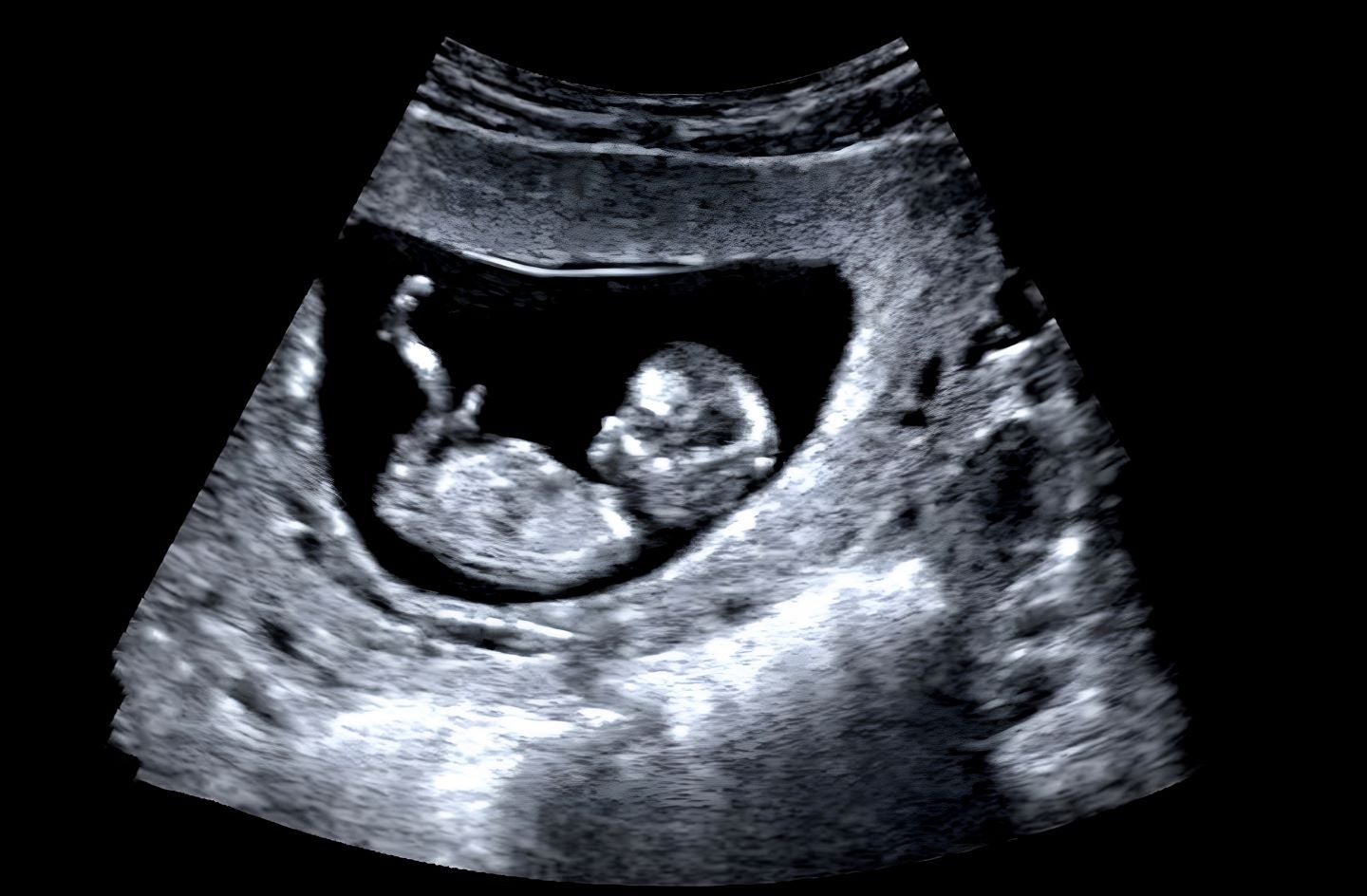 Pulsenmore stock up as at-home ultrasound secures FDA de novo authorisation