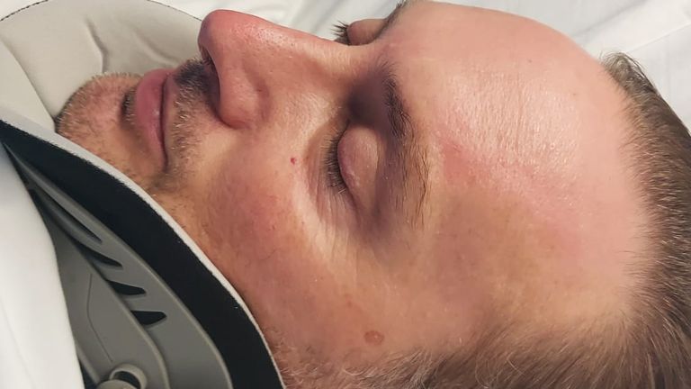 Mr O'Reilly suffered catastrophic injuries, including a broken neck and back. Pic: MIB