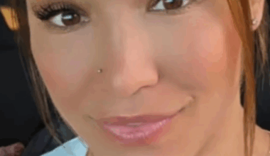 Man suffers nerve damage after parking complaint