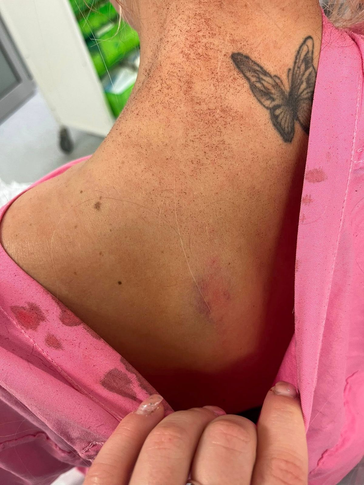 Meg shared pictures of her injuries on Facebook