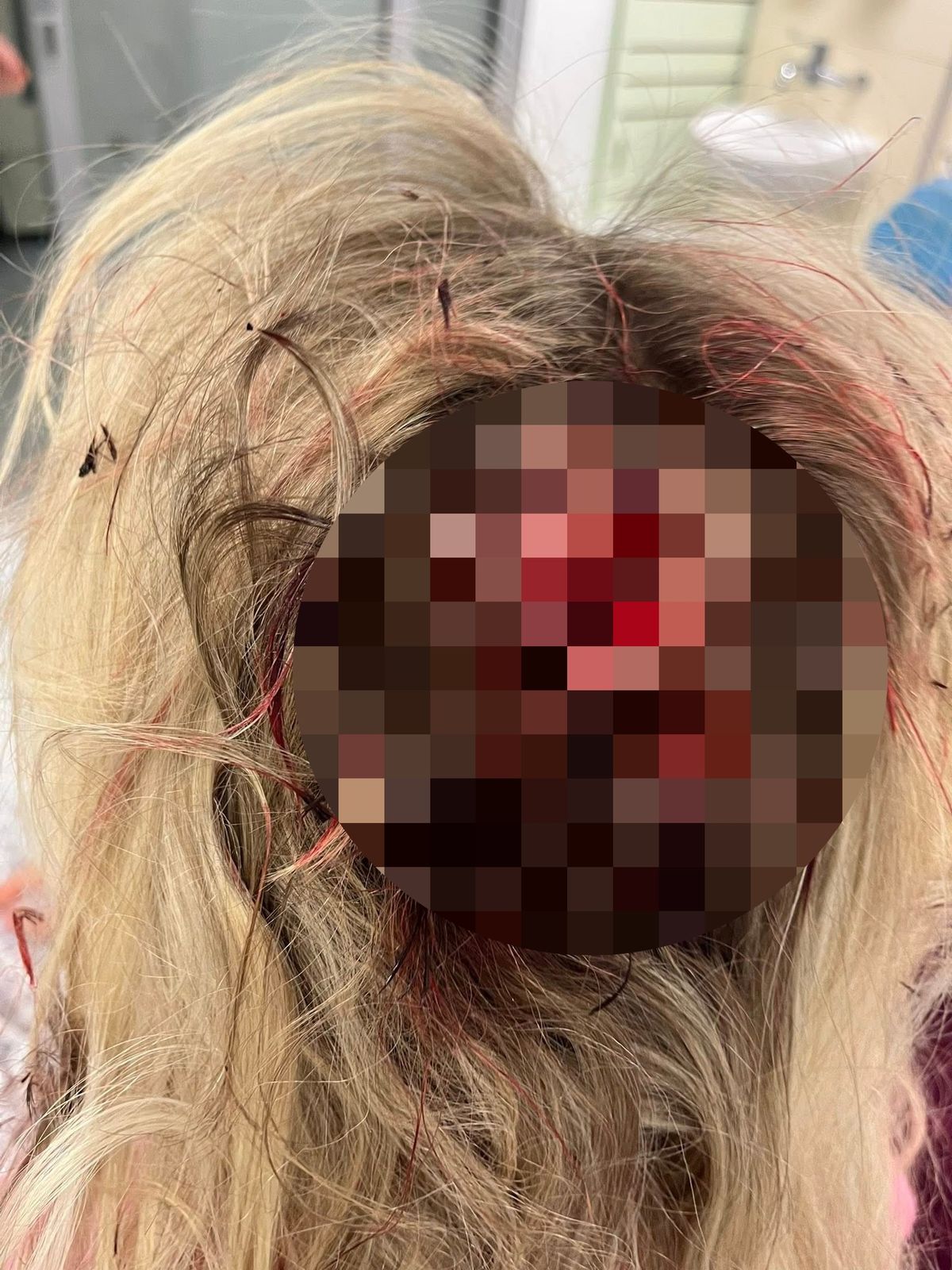 A nurse was allegedly battered from behind as she stopped to get a drink during her busy shift