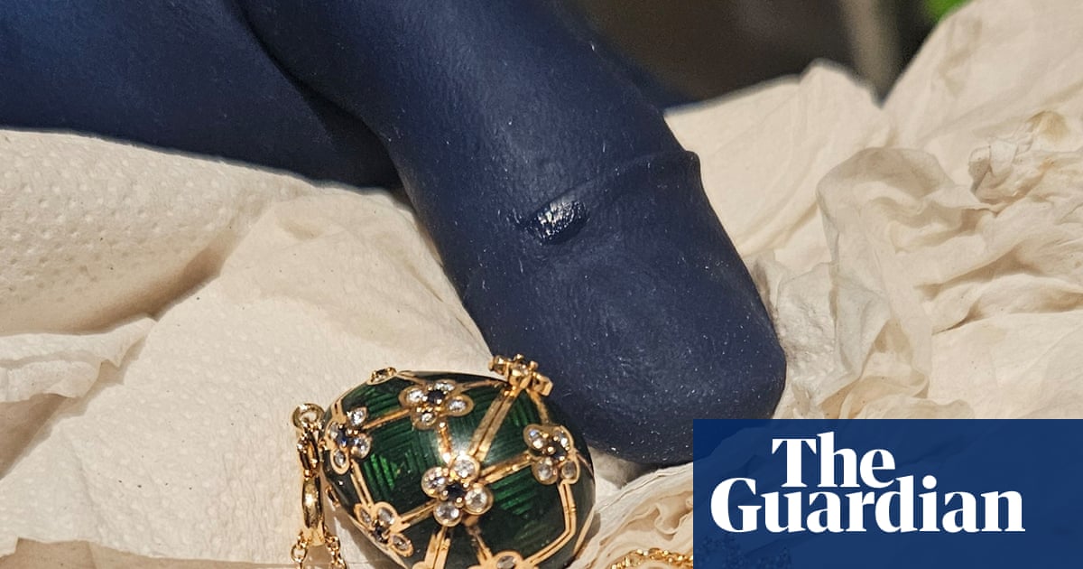 Patient police say they have recovered Fabergé pendant from man accused of swallowing it | New Zealand