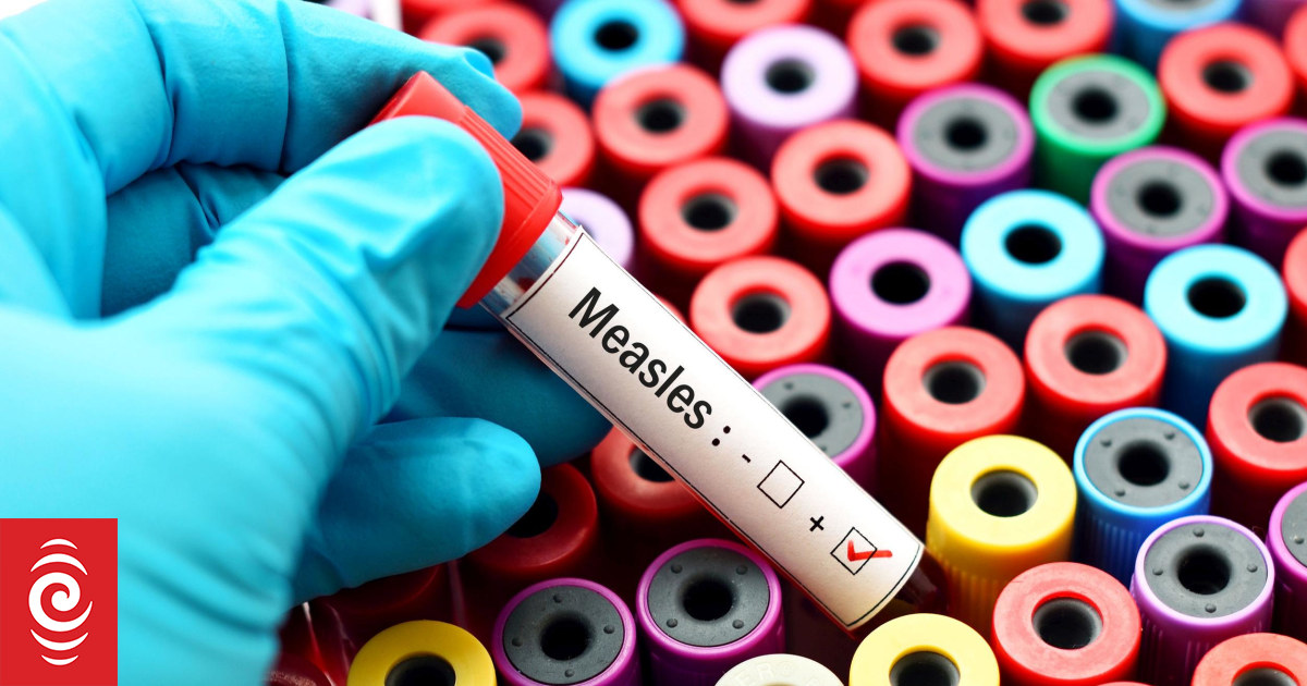 Paediatrician worries new measles wave spreading undetected