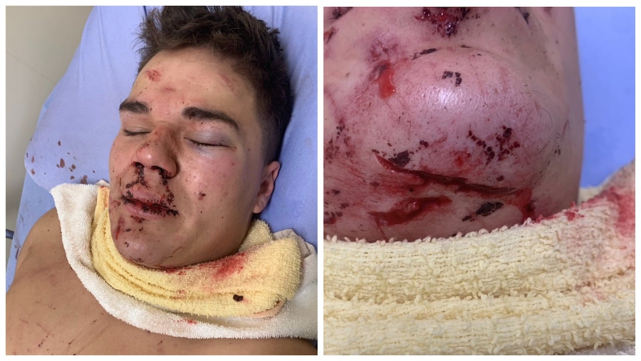 Two side-by-side photos of a man with various facial injuries. 