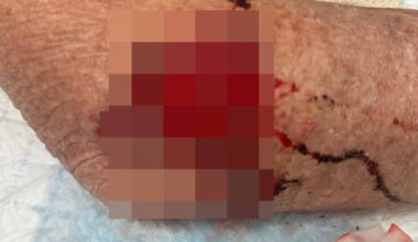 SunLive - Tauranga dog mauling: Woman pleads to keep dogs