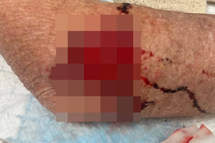 SunLive - Tauranga dog mauling: Woman pleads to keep dogs