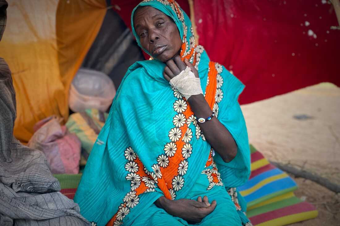 An injured Sudanese woman who fled el-Fasher city, after Sudan's paramilitary forces killed hundreds of people in the western Darfur region, rsits in a tent at a camp in Tawila, Sudan, Friday, Oct. 31, 2025.