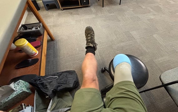 A shot of two legs, the right one is amputated under the knee in a compression sleeve. 