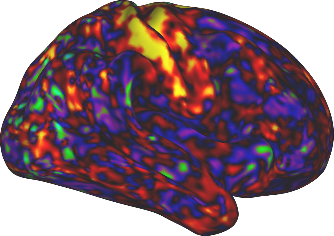 An image of the shows that as stimulants increase arousal, they calm (darker colors) various parts of the brain.